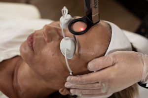 Alma Hybrid Laser Behandlung in der Lucerne Clinic